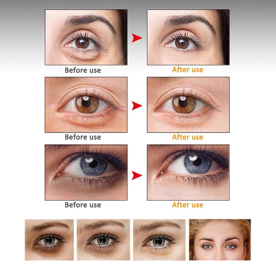 سيروم الوجه العضوي المضاد للتجاعيد وتفتيح البشرة